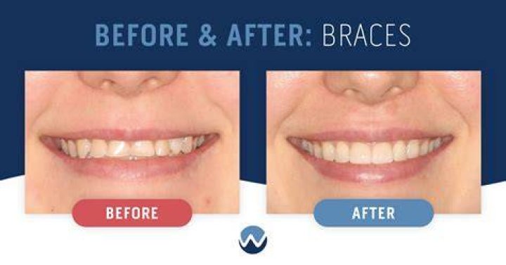 Are braces considered periodontics?