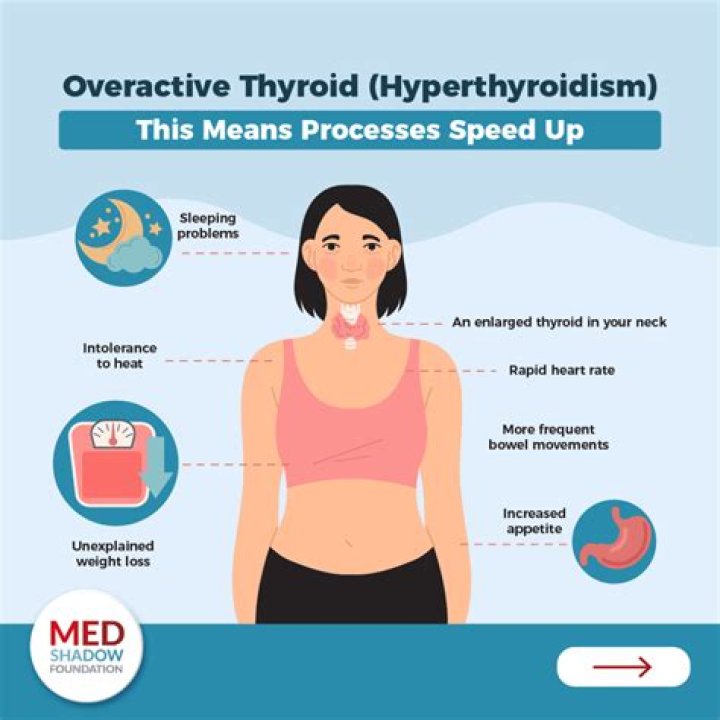 How do you feel when you have hyperthyroidism?
