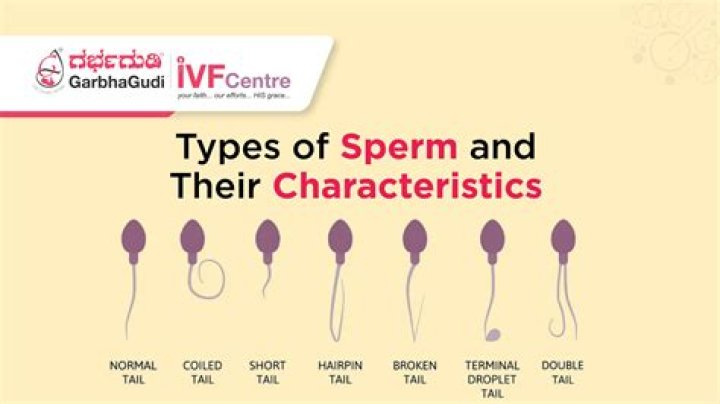 How is sperm different from egg?