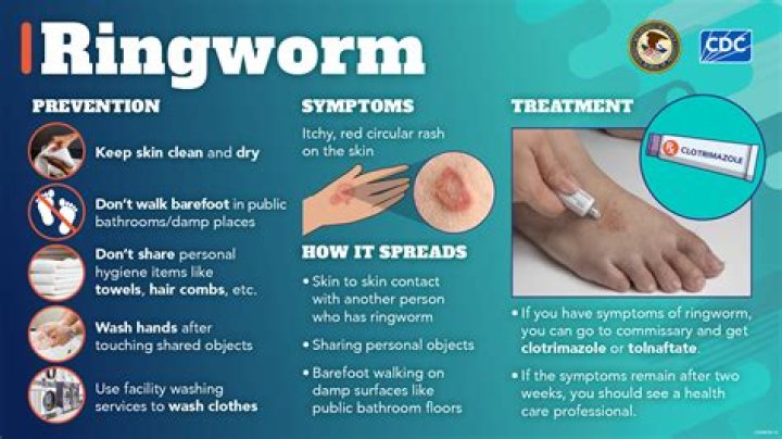 How long does it take to treat ringworm?