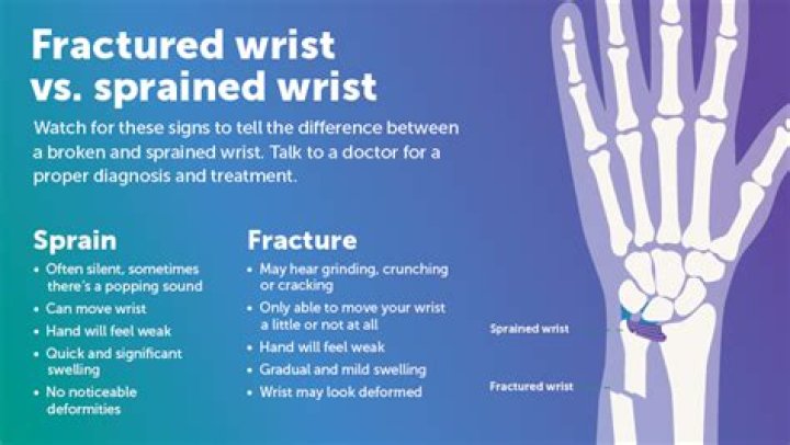 Is wrist broken or sprained?