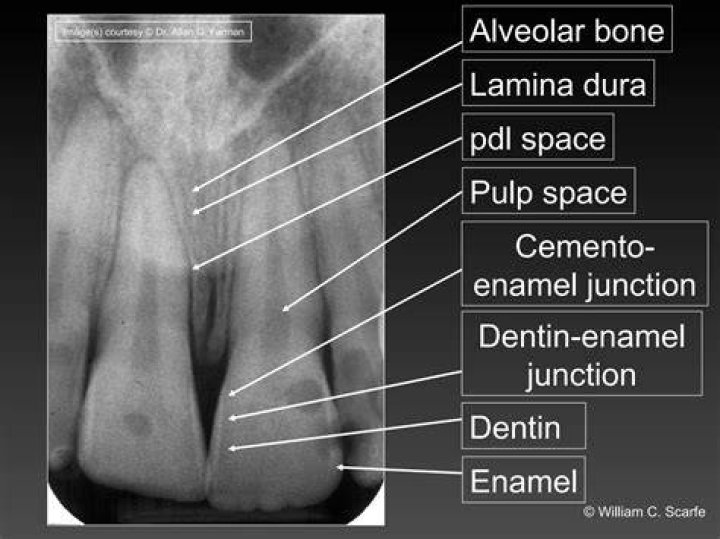 Where is acellular cementum found?