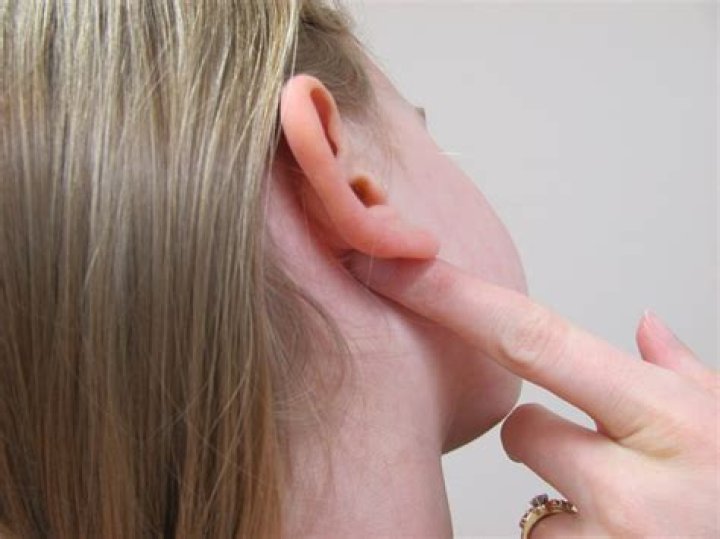 Why does behind my ear smell bad?